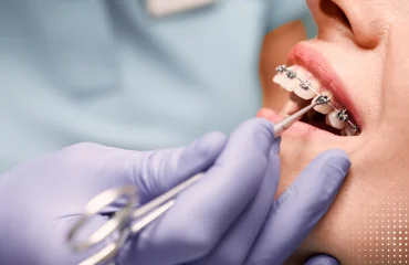 especializações em odontologia: mão de um dentista com luva azul mexendo no sorriso do paciente que utiliza aparelho ortodontico